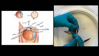 Eye Dissection Instructions [upl. by Krusche]