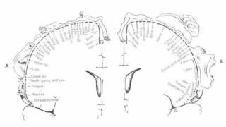 Difference Between Aphasia and Dysarthria [upl. by Eicats786]